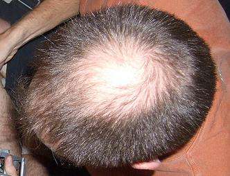 Cette odeur qui fait repousser vos cheveux et les renforce Cette odeur qui fait repousser vos cheveux et les renforce