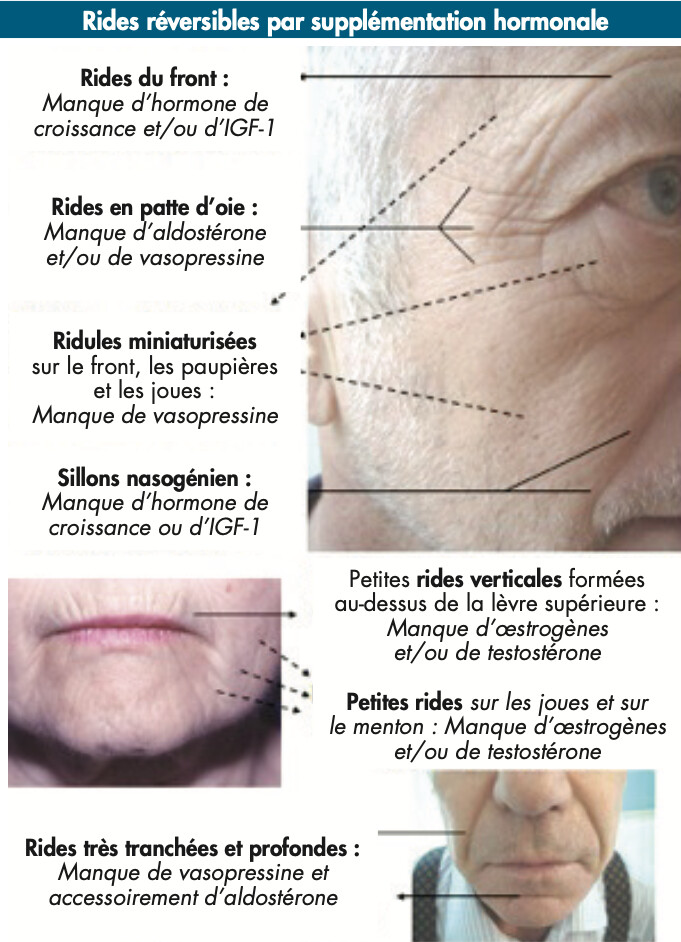 Rides Comment les atténuer et les faire disparaître ? Rides Comment les atténuer et les faire disparaître ?