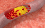 Cholestérol : quand devez-vous vous inquiéter ? Quand la BERGAMOTE viens à votre secours. Cholestérol : quand devez-vous vous inquiéter ? Quand la BERGAMOTE viens à votre secours.