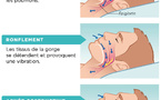 Apnées du sommeil : Trouver un soulagement naturel grâce à la naturopathie Apnées du sommeil : Trouver un soulagement naturel grâce à la naturopathie