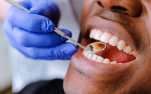 Comment le diabète affecte-t-il ta santé bucco dentaire ? Comment le diabète affecte-t-il ta santé bucco dentaire ?