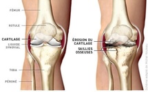 Vaincre l'Arthrose avec la Médecine Naturelle et l'Alimentation 🌿💪 - A Lire si vous souffrez ! Vaincre l'Arthrose avec la Médecine Naturelle et l'Alimentation 🌿💪 - A Lire si vous souffrez !